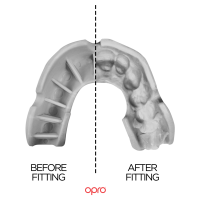 Opro Bronze Level Mouthguard White Opro Bronze Level Mouthguard White